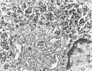 normal seromucinous salivary gland normal seromucinous salivary gland